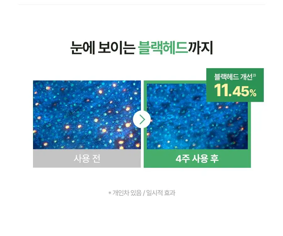 [코르티스PICK] 토리든 밸런스풀 시카 컨트롤 세럼 50ml 더블기획 (+20ml) 상세페이지 27